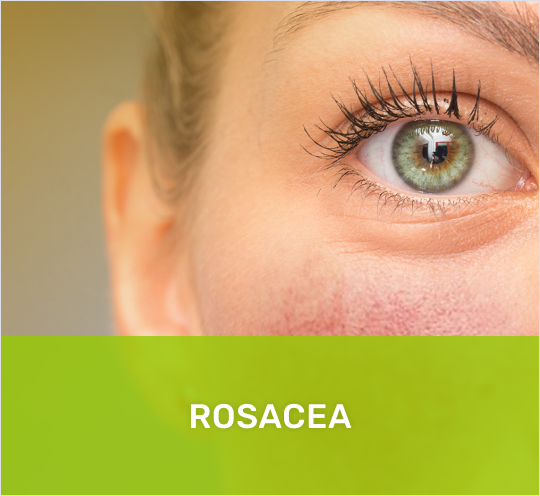 rosacea muenchen heilpraktiker - Spezialisierung