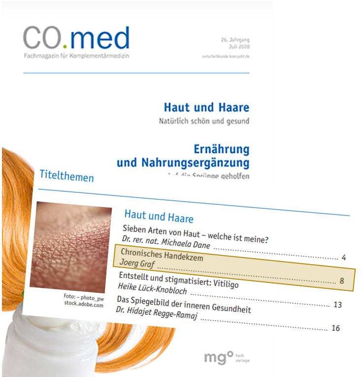 Inhaltsverzeichnis der CO.med vom Juli 2020 mit dem Beitrag Chronisches Handekzem